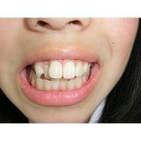 ★歯フェチ写真★18歳清楚●リ系短大生の歯