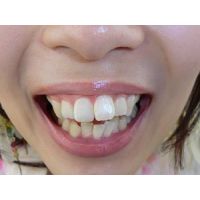 期間限定再販売作品#047 その①