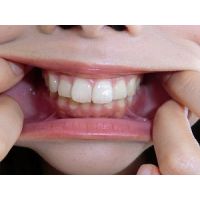 期間限定再販売作品#032