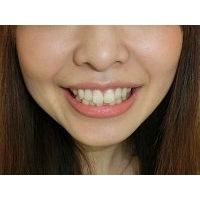 ★歯フェチ写真★26歳歯科衛生士の歯