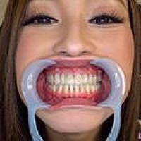 【歯フェチ】桐嶋りのさんの歯を観察しました！  ダウンロード